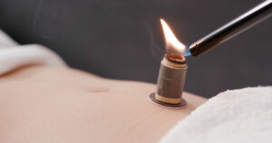 Moxibustion For Colds