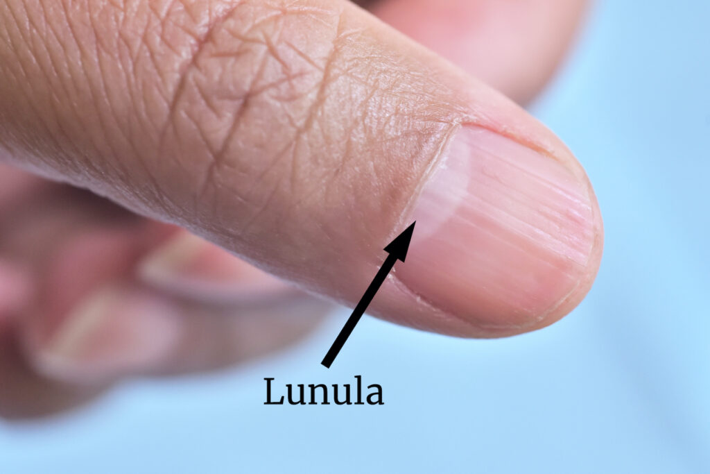 Fingernail Lunula in Eastern Medicine