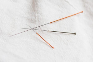 Acupuncture in Eastern Medicine