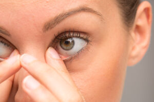Fix Dark Under Eye Circles With Eastern Medicine