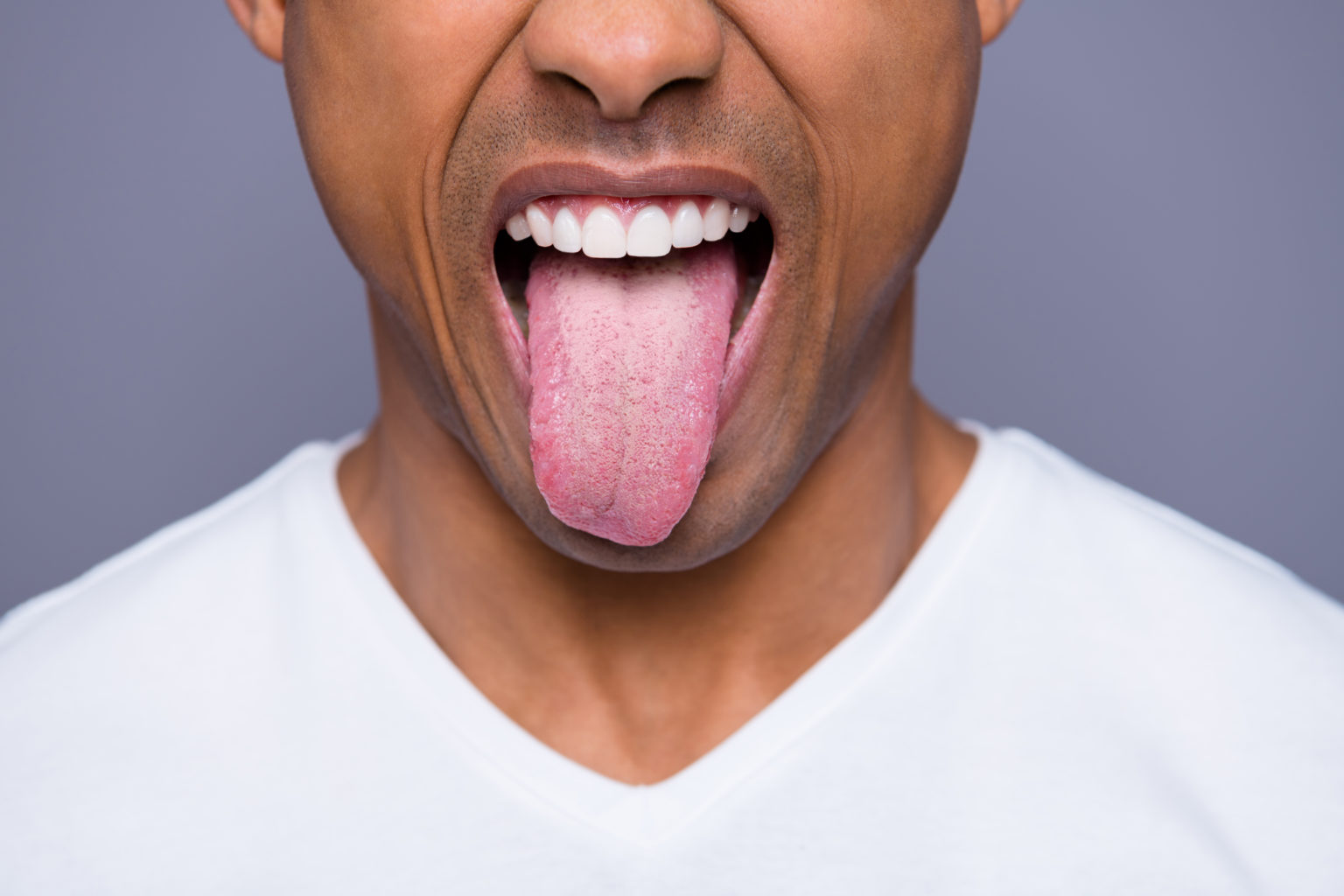 Tongue Mapping 101 - welleum